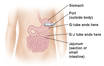  photo GJpic_zpsbf9d24d4.png