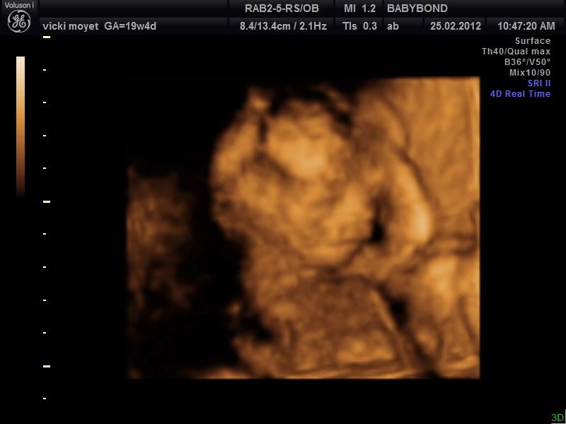 dating scan babybond 4,976 people have already reviewed ultrasound direct ️⭐️⭐️⭐️⭐️ of babybond went well with your early/dating scan and babies. dating scan babybond 4,976 people have already reviewed ultrasound direct ️⭐️⭐️⭐️⭐️ of babybond went well with your early/dating scan and babies.