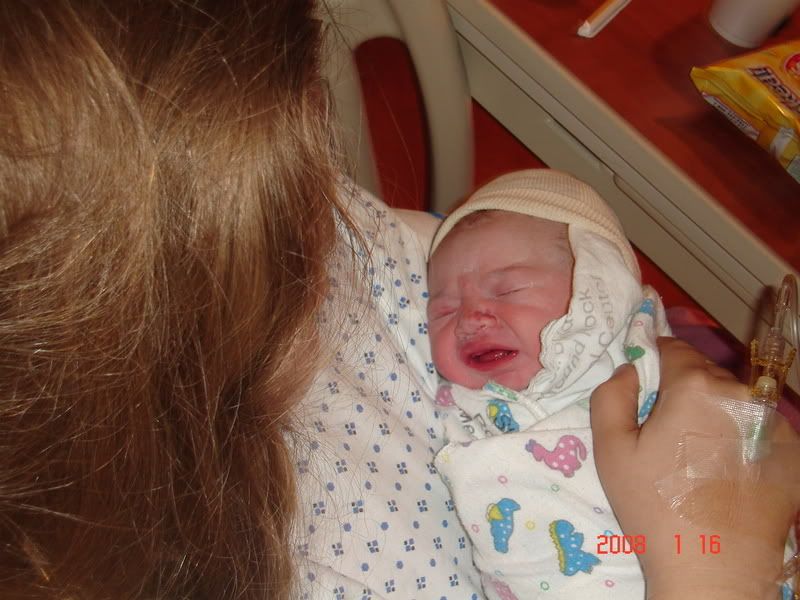 strawberry marks? BabyGaga