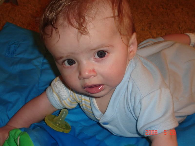 strawberry marks? BabyGaga