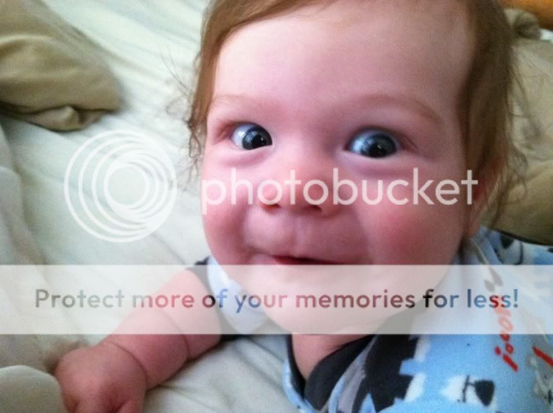 Slightly lazy eye? BabyCenter